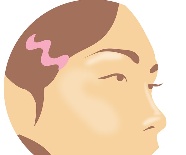 Illustration of a womans side profile with B-Goldi applied to her cheek, nose, and underneath the brow bone. ad image